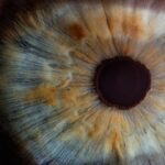 Pterygium Surgery   Ocular Surface Reconstruction in Kandivali   Mira Road
